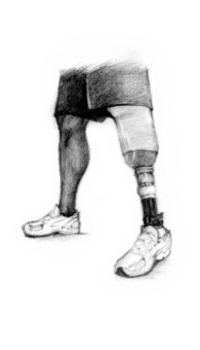 Below Knee Prosthesis – Rinella Prosthetics & Orthotics