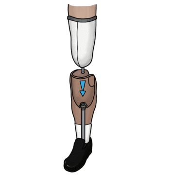 Below Knee Prosthetic Leg Cost